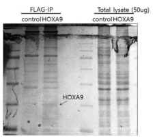 비소세포폐암 세포주에서 HOXA9-flag와 결합하는 단백질 확인하기 위한 SDS-PAGE