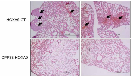세포투과 CPP33-HOXA9 융합 펩타이드에 의한 폐암 nodule 억제함을 확인