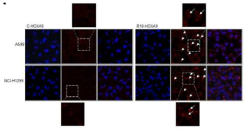 세포투과 HOXA9 융합단백질의 세포투과를 immunofluorescence로 확인