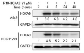 시간에 따라 세포투과 HOXA9 융합단백질의 세포투과 정도 확인