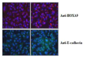 세포투과 HOXA9 융합단백질에 의해 E-cadherin 발현의 증가