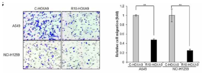 비소세포폐암 세포주에서 세포투과 HOXA9 융합단백질이 migration을 억제