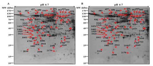 Representative Two-dimensional gel electrophoresis maps of the control and pectolinarigenin-treated MKN28 cells