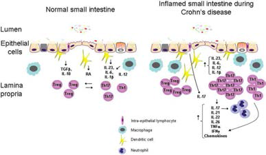 Dysregulation of intestinal immune homeostasis in Crohn′s disease. (Inflamm Bowel Dis, 2009) Treg : regulatory T cell, RA : reinoic acid