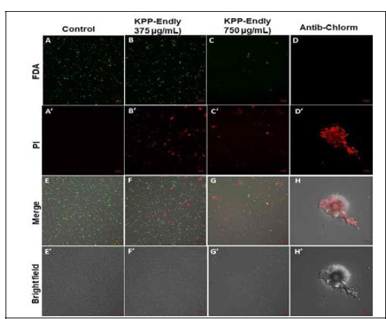 Dead and live cells staining of K. pneumoniae cells by CLSM images upon treatment of the purified KPP-1 endolysin for 10 h. (from top to bottom: FDA-signal; PI-signal; composite of FDA and PI signal) and bright field images. scale: 10 µm)