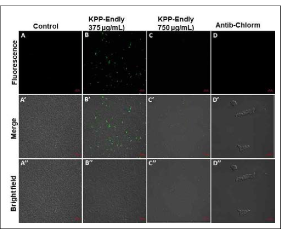 ROS production upon purified KPP-1 rec. endolysin treatment against Klebsiella pneumoniae cells analyzed by CLSM (from top to bottom: H2DFDA-signal unger green fluorescence signal; composite of H2DFDA-signal under green fluorescence and bright field; bright field images). scale; 10 ㎛)