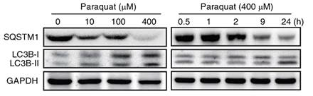 파라쿼트 처리에 따른 망막색소상피세포의 자가포식작용 유발. 파라쿼트 처리 농도 (좌측 그림) 및 시간 (우측 그림)에 따른 자가포식작용 마커 단백질의 발현 변화