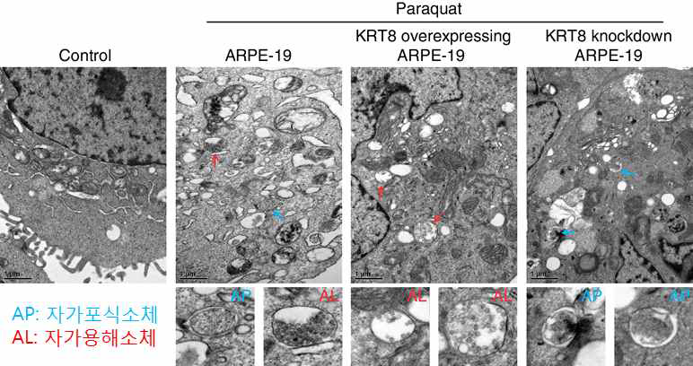 전자현미경을 통한 세포 내 자가포식소체 및 자가용해소체 관찰