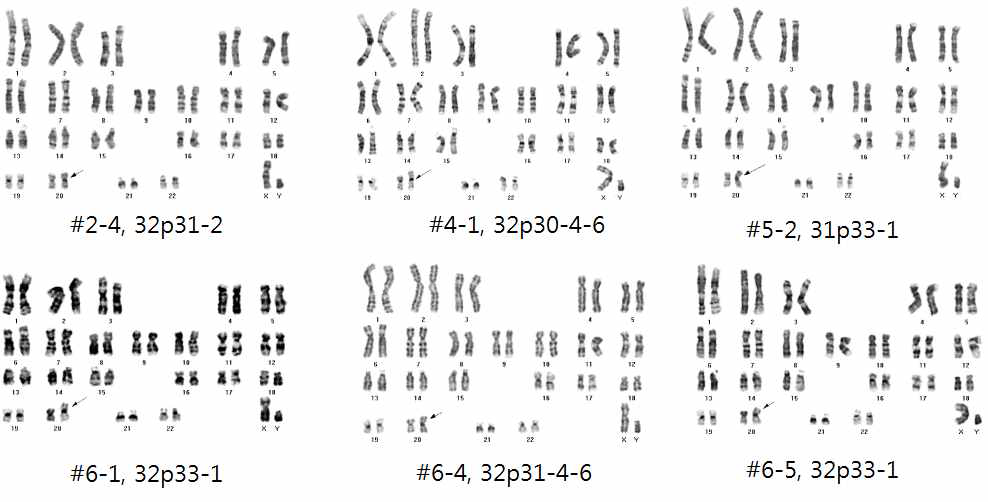 6개의 SNUhES32-PITX3-mCherry 세포의 염색체 검사 결과 (46,XY,i(20)(q10))