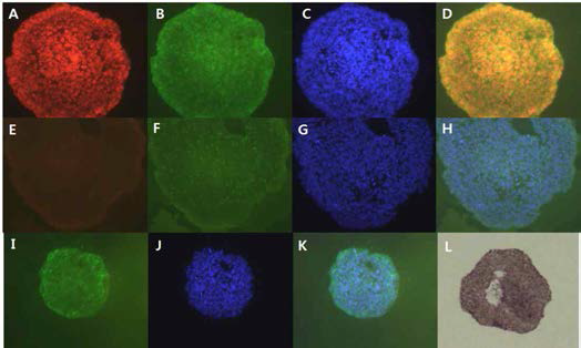#4-1, SNUhES32(p53)의 미분화 마커 발현 확인 A: Oct-4, B: SSEA-4, C: DAPI, D: Oct-4&SSEA-4 merge, E: Tra-1-81, F: SSEA-3, G: DAPI, H: Tra-1-81&SSEA-3 merge, I: Tra-1-60, J:DAPI, K: merge, L: AP 염색, A-K: x200, L:x30