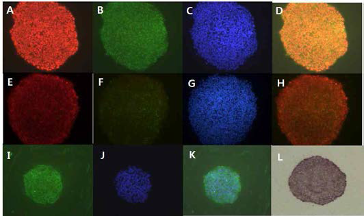 #6-4, SNUhES32(p54)의 미분화 마커 발현 확인 A: Oct-4, B: SSEA-4, C: DAPI, D: Oct-4&SSEA-4 merge, E: Tra-1-81, F: SSEA-3, G: DAPI, H: Tra-1-81&SSEA-3 merge, I: Tra-1-60, J:DAPI, K: merge, L: AP 염색, A-K: x200, L:x30