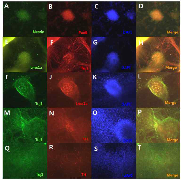 feeder-free (VTN-N+E8)에서 배양된 SNUhES32의 도파민 신경세포 마커 발현 확인 A-D: 초기 도파민 신경세포 마커인 Nestin, Pax6, E-H: 도파민 신경세포 분화인자 처리 1주차에 Lmx1a, Tuj1, I-L: 도파민 신경세포 분화인자 처리 3주차에 Tuj1, Lmx1a, M-P: 도파민 신경세포 분화인자 처리 3주차 Tuj1, TH, Q-T: 도파민 신경세포 분화인자 처리 5주차 Tuj1, TH (all, x200)