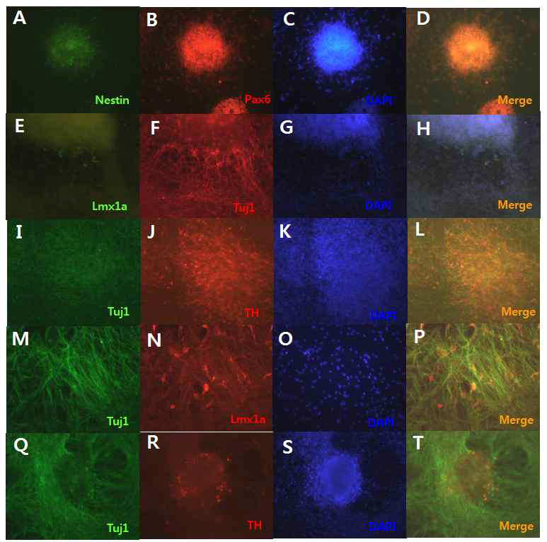 feeder-free (VTN-N+E8)에서 배양된 SNUhES46의 도파민 신경세포 마커 발현 확인 A-D: 초기 도파민 신경세포 마커인 Nestin, Pax6, E-H: 도파민 신경세포 분화인자 처리 1주차에 Lmx1a, Tuj1, I-L: 도파민 신경세포 분화인자 처리 3주차에 Tuj1, TH, M-P: 도파민 신경세포 분화인자 처리 3주차 Tuj1, Lmx1a, Q-T: 도파민 신경세포 분화인자 처리 5주차 Tuj1, TH (all, x200)