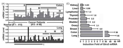 (A) 5명의 정상인과 43명의 암 환자를 대상으로 Glrx3의 mRNA 레벨을 조사한 결과 정상인에 비해 높은 발현을 알 수 있음. (C) 다른 암에서의 발현량과 비교한 그림으로 대장암과 폐암에서의 높은 발현을 보임