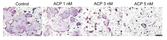 BTK 저해제인 acalabrutinib 의 파골세포 분화 억제 효과