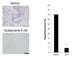 BTK 저해제인 acalabrutinib 의 파골세포 활성 억제 효과