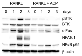 BTK 저해제인 acalabrutinib 의 파골세포 분화 조절 NFATc1 단백질 발현에 미치는 영향