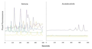 BTK 저해제인 acalabrutinib 의 파골세포 calcium oscillation 에 미치는 영향