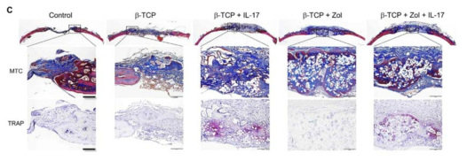 IL-17 에 의한 calvarial bone remodeling 촉진 확인 결과