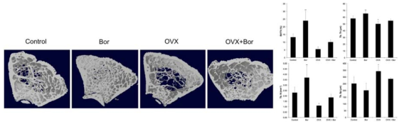Bortezomib에 의한 난소 절제술 후 골량 감소 억제 효과