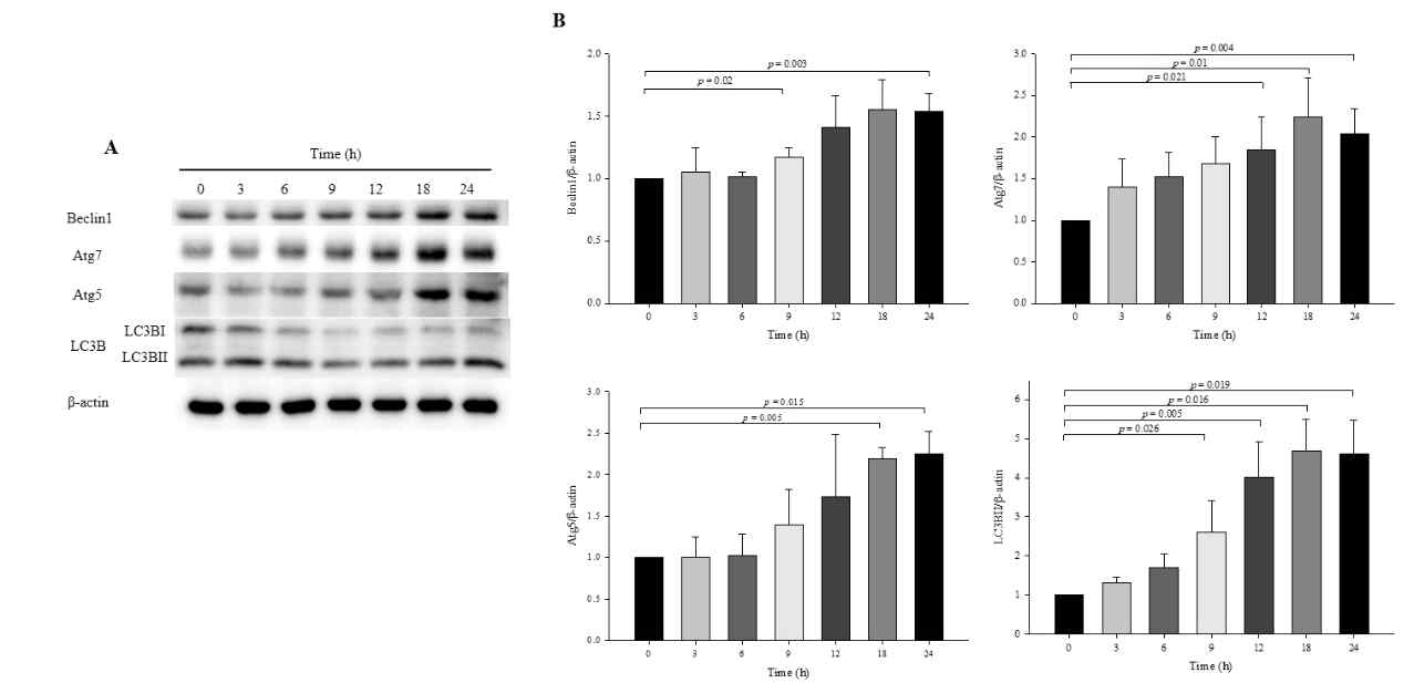 Effect of OXY on autophagy development at various time points. Cells were treated with 10 μg/mL OXY, and expression levels of autophagy-associated proteins (Beclin-1, Atg7, Atg5, and LC3B-II) were determined by Western blotting (A) and quantified (B). Each value indicates the mean ± SD of three independent experiments performed
