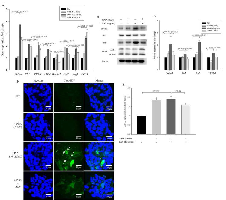 Effect of an ER stress inhibitor on expression of autophagy-related genes and proteins. Cells were treated with OXY (10 μg/mL) with or without the ER stress inhibitor 4-PBA. Expression levels of IRE1α, XBP1, PERK, ATF4, Beclin-1, Atg5, Atg7, and LC3B were determined by qPCR (A). Expression levels of Beclin-1, Atg7, Atg5, and LC3B proteins were measured by Western blotting (B) and quantified (C). Autophagic vesicle formation was detected using the CYTO-ID autophagy green dye and observed by fluorescence microscopy; white arrows indicate autophagosomes (600×) (D), which were quantified (E). Each value indicates the mean ± SD of three independent experiments performed in triplicate