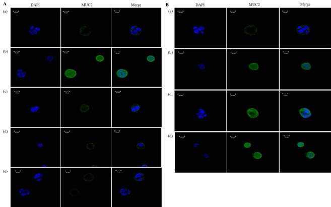 Inhibition of MUC2 expression in OXY-treated LS 174T cells by gallotannin and RNA interference. (A) MUC2 protein levels were detected using ICC (600×) in LS 174T cells treated with gallotannin for 24 h. (a) Negative control, (b) 10 μg/mL OXY, (c) 10 μg/mL OXY + gallotannin (5 μM), (d) 10 μg/mL OXY + gallotannin (10 μM) and (e) gallotannin (10 μM). (B) MUC2 protein levels were detected in LS 174T cells treated with siRNA-NRK1 or siRNA-NaPRT1 for 24 h. (a) Negative control, (b) 10 μg/mL OXY, (c) 10 μg/mL OXY + 25 nM siRNA-NaPRT1 and (d) 10 μg/mL OXY + 25 nM siRNA-NRK1
