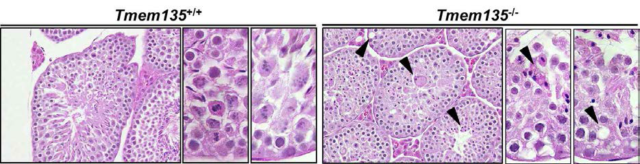 Tmem135 결손 마우스의 정자형성 이상 (arrowheads, morphological abnormality)