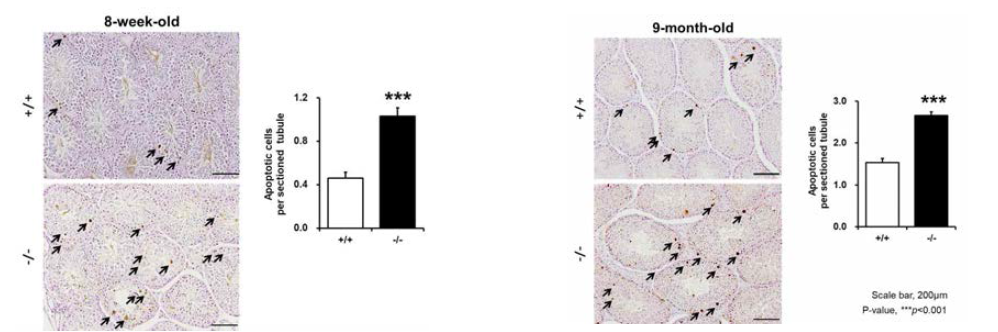Slc25a17 결손마우스 정세관의 세포사멸 증가 (8주령, 좌; 9개월령, 우)