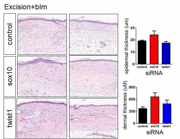trauma+bleomycin scar model에서 twist1, sox10의 발현을 저해하는 siRNA를 2주간 처리한 후 흉터 조직의 변화