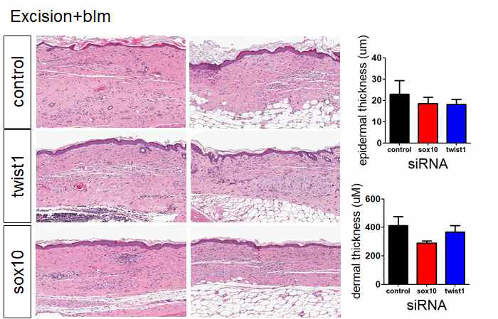 trauma+bleomycin scar model에서 twist1, sox10의 발현을 저해하는 siRNA를 3주간 처리한 후 흉터 조직의 변화