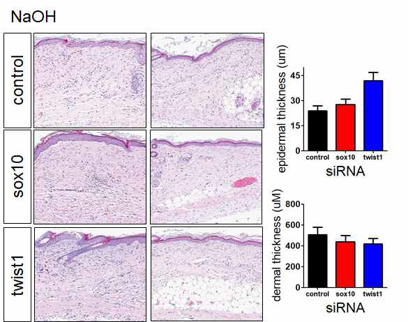 NaOH-induced scar model에서 twist1, sox10의 발현을 저해하는 siRNA를 2주간 처리한 후 흉터 조직의 변화