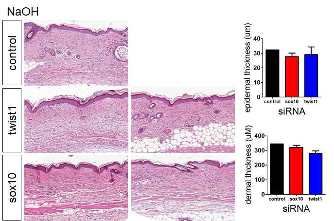 NaOH-induced scar model에서 twist1, sox10의 발현을 저해하는 siRNA를 3주간 처리한 후 흉터 조직의 변화