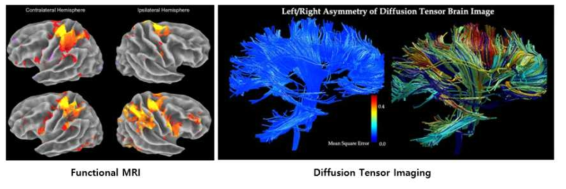 뇌영상(functional MRI, Diffusion Tensor Imaging) 데이터