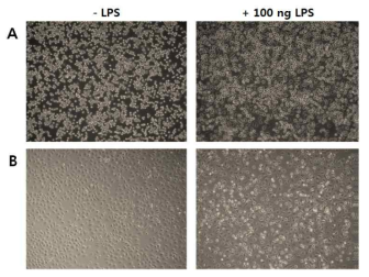 LPS에 의해 유도된 세포 형태학적 변화. (A) Raw 264.7 (양성 대조군), (B) 간 대식세포