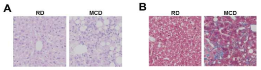(A) RD와 MCD를 8주 동안 먹인 마우스 간조직에서 손상된 간세포 주변에 모여 있는 면역세포들 (B) RD와 MCD를 8주 동안 먹인 마우스 간조직의 Trichrome 염색