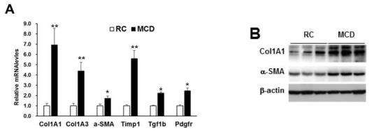 (A) RD와 MCD를 8주동안 먹인 마우스 간조직에서 real-time PCR을 통한 섬유화 마커 유전자들의 발현 변화 관찰 (B) Western blot을 통한 간섬유화 마커 단백질 발현 변화 관찰