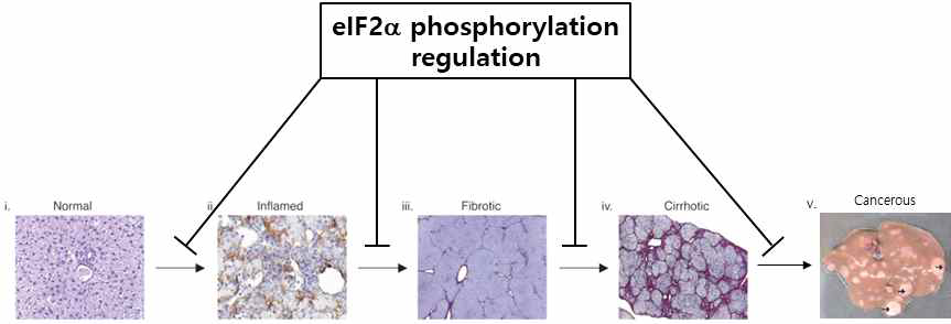 대사성 간질환에서 eIF2α 인산화의 역할