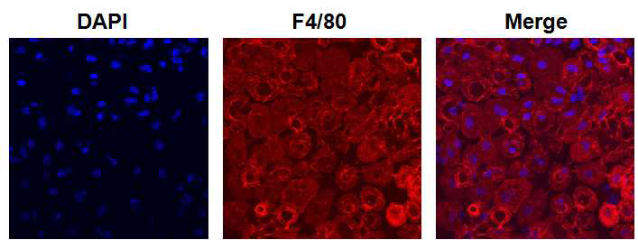 쿠퍼세포 분리 방법 3에 의해 분리된 세포의 F4/80 면역형광염색. Nuclear (DAPI, Blue), F4/80 (Red)