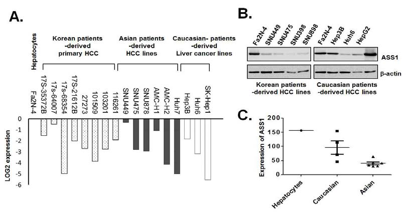 환자 유래 간암세포(A), 정상 간세포주 및 간암 세포주(B), 인종(C)에 따른 ASS1 발현량