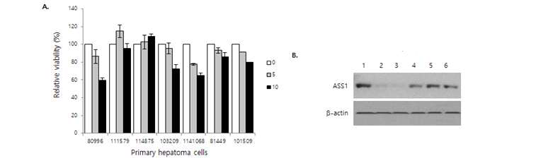 간암환자 유래 간암세포에 대한 cisplatin의 반응성과 ASS1의 발현양