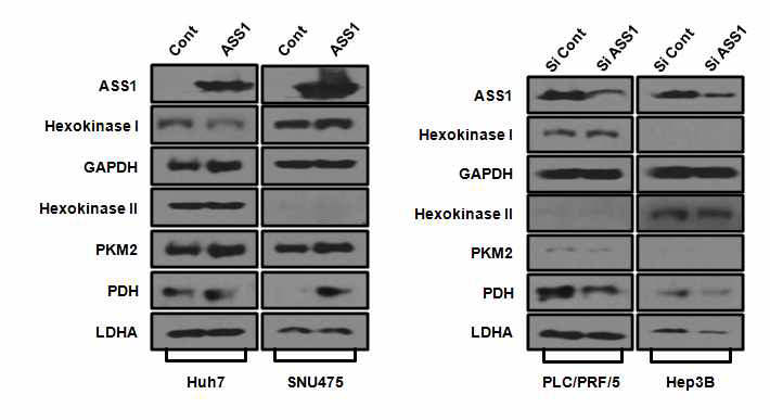 ASS1 발현에 의한 해당과정 효소 발현 변화