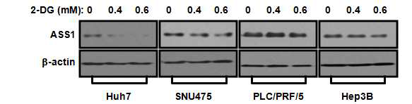 해당과정 저해제인 2-DG에 의한 ASS1의 발현 변화