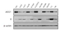 간암세포주에서 후보 인자 X와 ASS1의 발현 비교