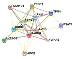 SORD 단백질과 glycolysis 관련 단백질들과의 연관성