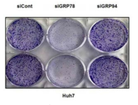 GRP78 발현 감소에 따른 세포 증식 억제