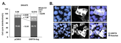 GRP78 발현에 따른 세포주기 변화(A) 및 세포 분열 변화(B)