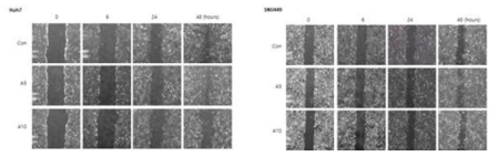 아르기닌에 의한 간암 세포주의 migration assay