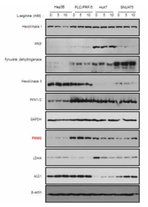 아르기닌에 의한 간암 세포주의 해당과정 관련 효소들의 발현 변화