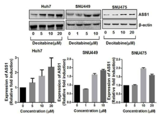 데시타빈 처리에 의한 ASS1 발현량 변화